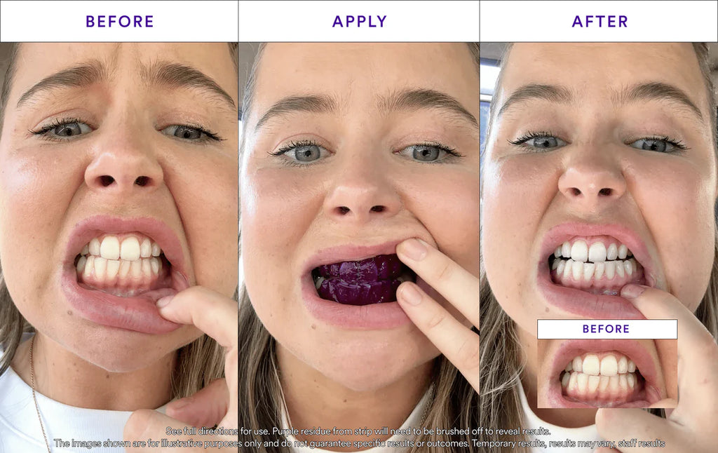 Purple Whitening Strips
